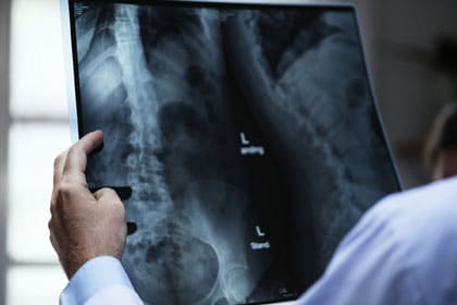 productos promed implantes